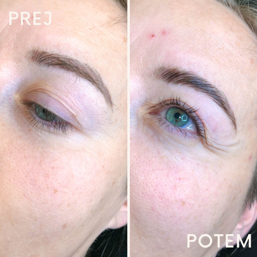 Prej in potem Lash Lift